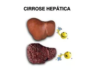 cirrose hep tica