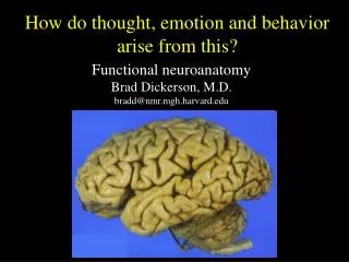 Functional neuroanatomy Brad Dickerson, M.D. bradd@nmr.mgh.harvard.edu