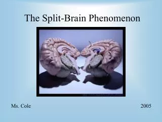 the split brain phenomenon