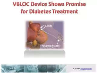 VBLOC Device Shows Promise for Diabetes Treatment