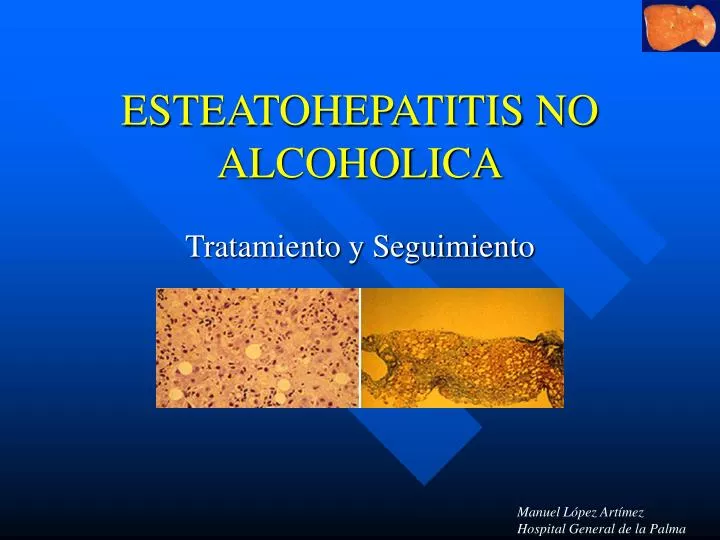 esteatohepatitis no alcoholica