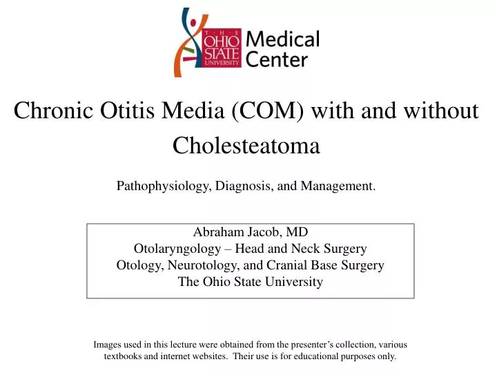 chronic otitis media com with and without cholesteatoma pathophysiology diagnosis and management