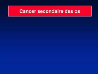 cancer secondaire des os