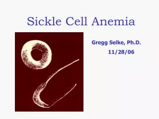 Sickle Cell Anemia