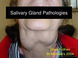 Salivary Gland Pathologies