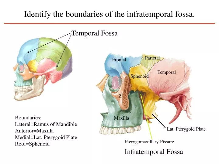 identify the boundaries of the infratemporal fossa