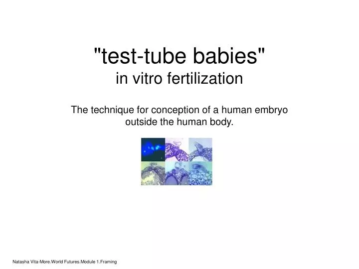 test tube babies in vitro fertilization