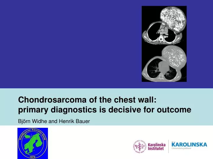 chondrosarcoma of the chest wall primary diagnostics is decisive for outcome