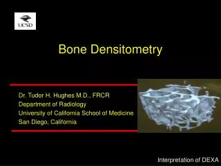Bone Densitometry