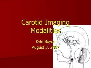 Carotid Imaging Modalities