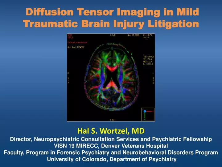 d iffusion tensor imaging in mild traumatic brain injury litigation
