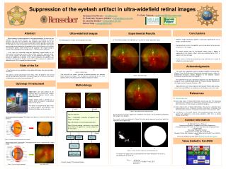 Suppression of the eyelash artifact in ultra-widefield retinal images