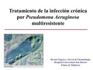 Tratamiento de la infección crónica por Pseudomona Aeruginosa multiresistente