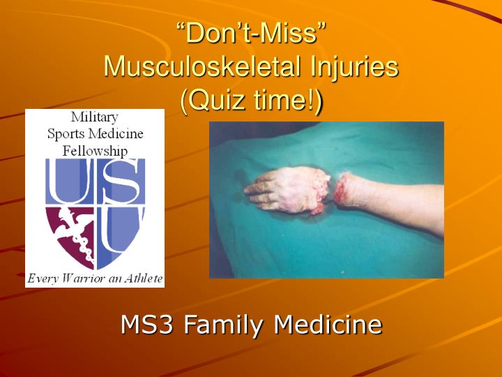 don t miss musculoskeletal injuries quiz time