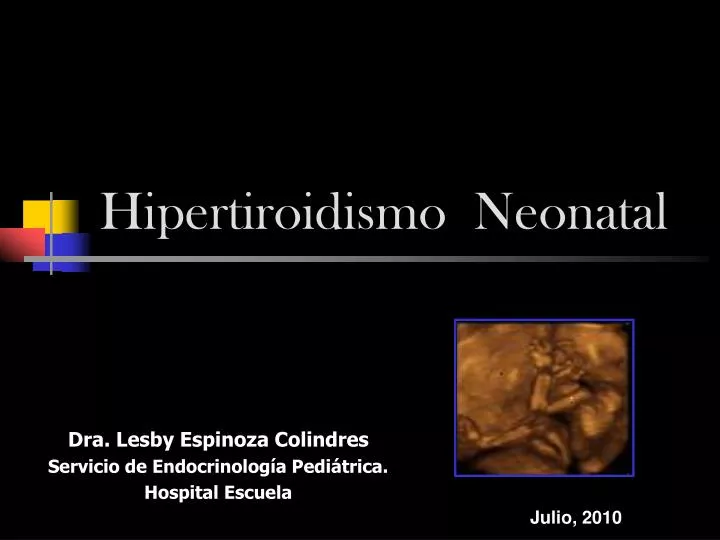 hipertiroidismo neonatal
