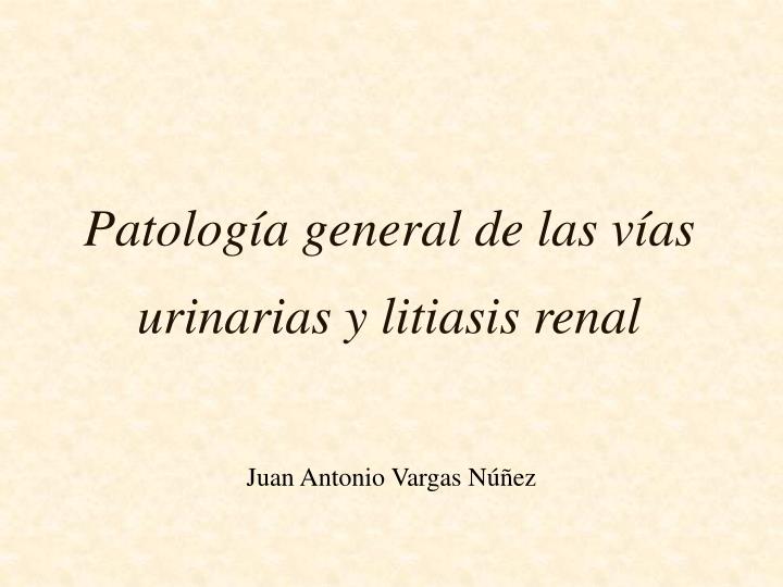 patolog a general de las v as urinarias y litiasis renal