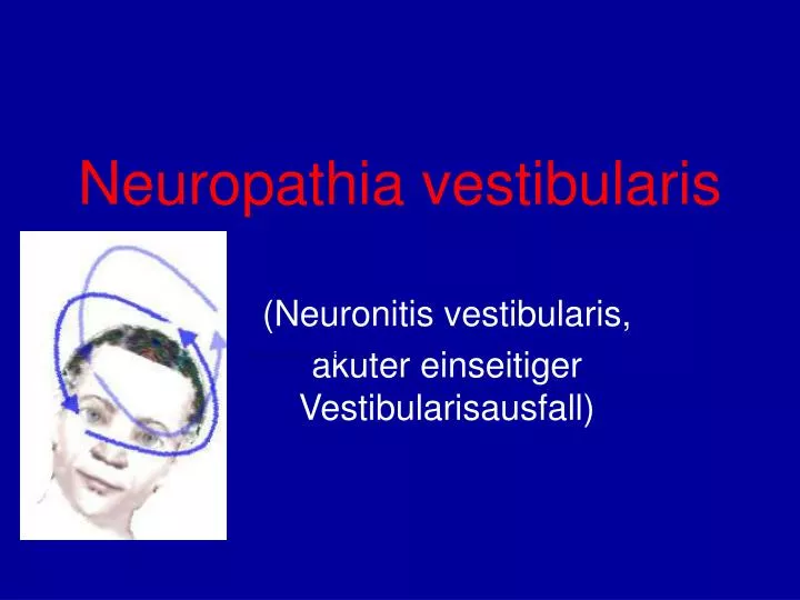 neuropathia vestibularis
