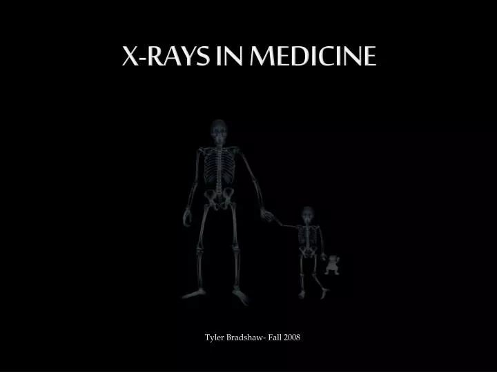 x rays in medicine