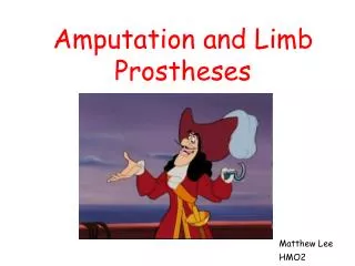 Amputation and Limb Prostheses