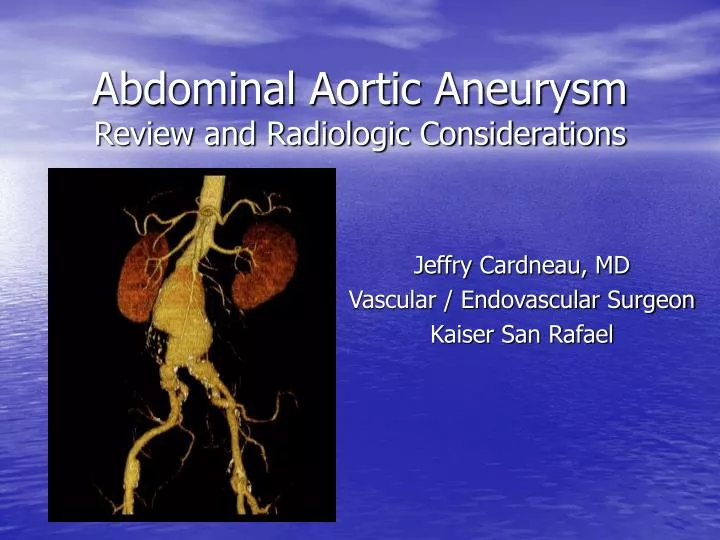abdominal aortic aneurysm review and radiologic considerations