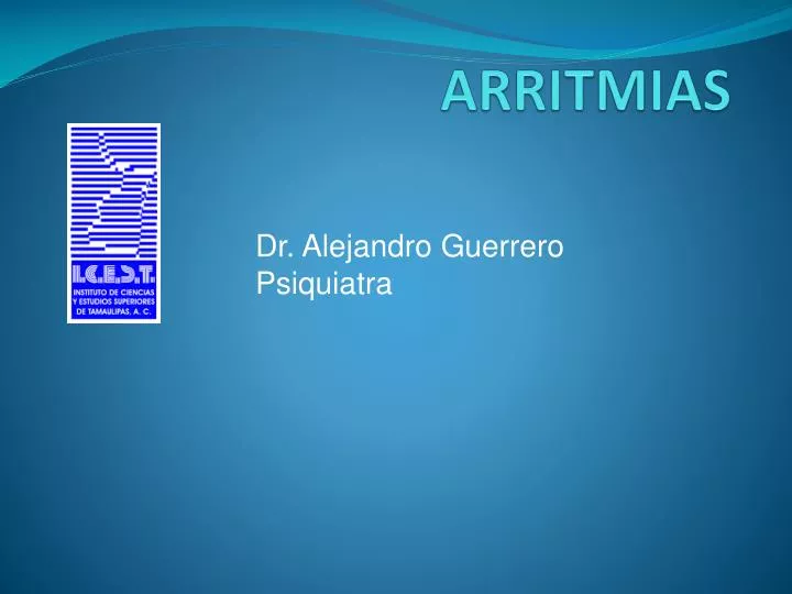 arritmias