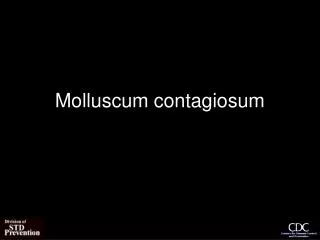 Molluscum contagiosum