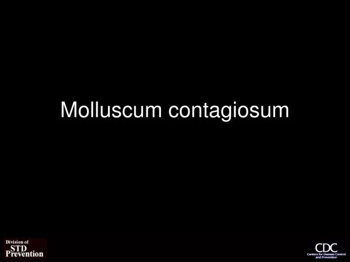 molluscum contagiosum