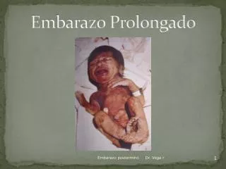 embarazo prolongado