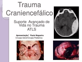 trauma craniencef lico