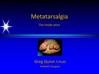 Metatarsalgia The inside story