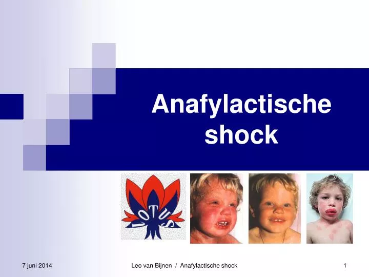 anafylactische shock