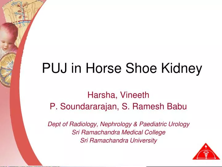 puj in horse shoe kidney