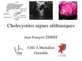 cholecystites aigues alithiasiques