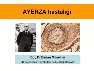 ayerza hastal