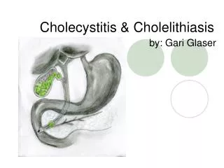 Cholecystitis &amp; Cholelithiasis