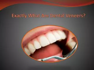 exactly what are dental veneers?