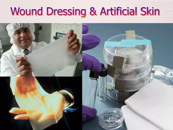 wound dressing artificial skin
