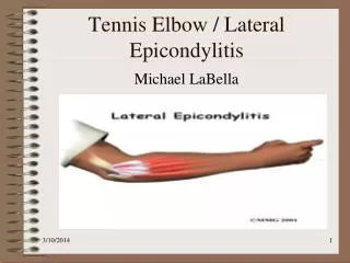 Tennis Elbow / Lateral Epicondylitis