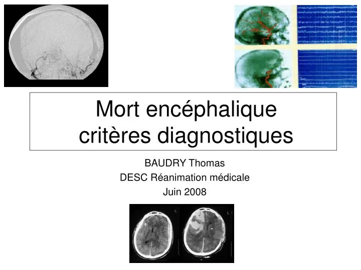 mort enc phalique crit res diagnostiques