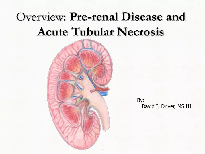 overview pre renal disease and acute tubular necrosis