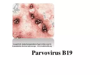 Parvovirus B 19