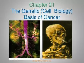 Chapter 21 The Genetic (Cell Biology) Basis of Cancer