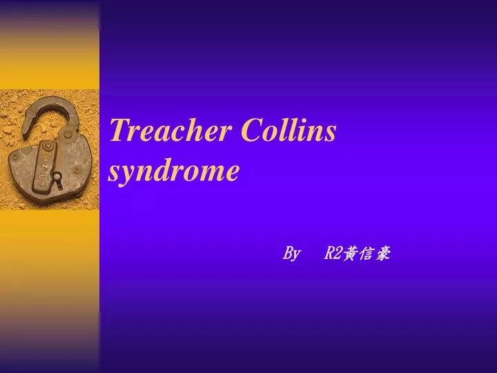 treacher collins syndrome
