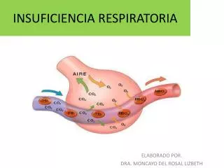 insuficiencia respiratoria
