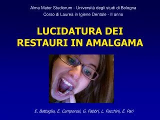 lucidatura dei restauri in amalgama