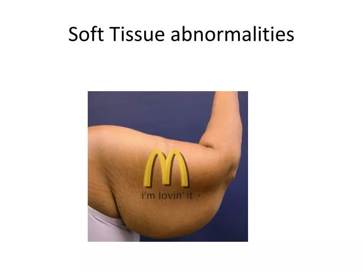 soft tissue abnormalities