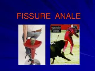 fissure anale