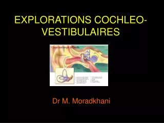 explorations cochleo vestibulaires