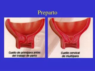 preparto