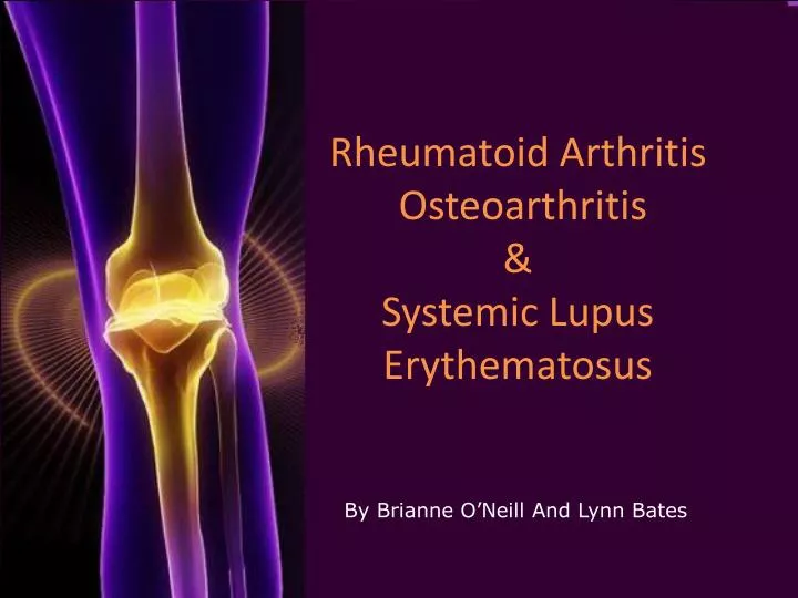 rheumatoid arthritis osteoarthritis systemic lupus erythematosus